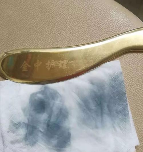 手被冰箱冻伤了怎么办？如何快速缓解疼痛并预防冻伤？