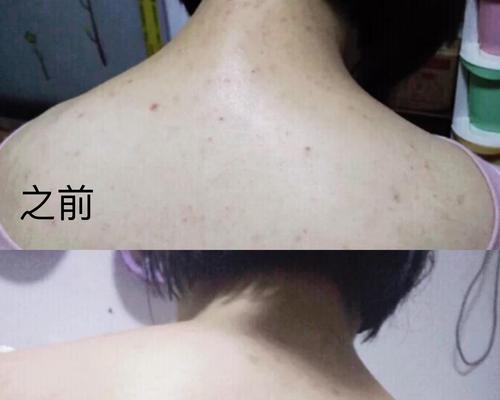 热水器需要清洗吗？洗后皮肤痒是信号吗？