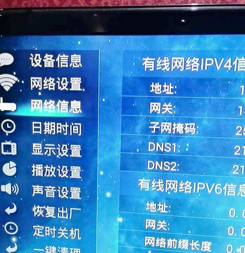 游戏机顶盒网线安装步骤是什么？安装中常见问题？
