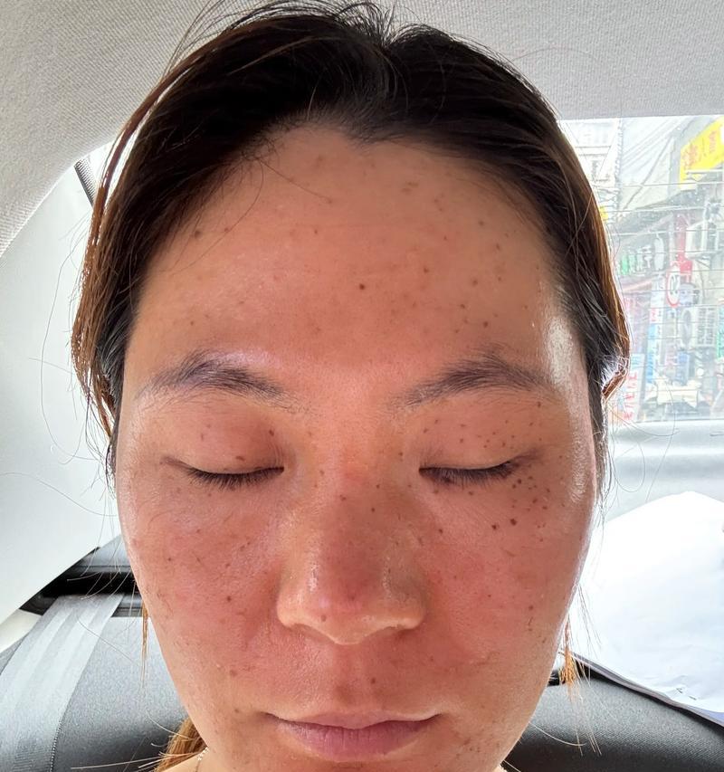 原相机出现多斑的原因是什么？如何清除这些斑点？